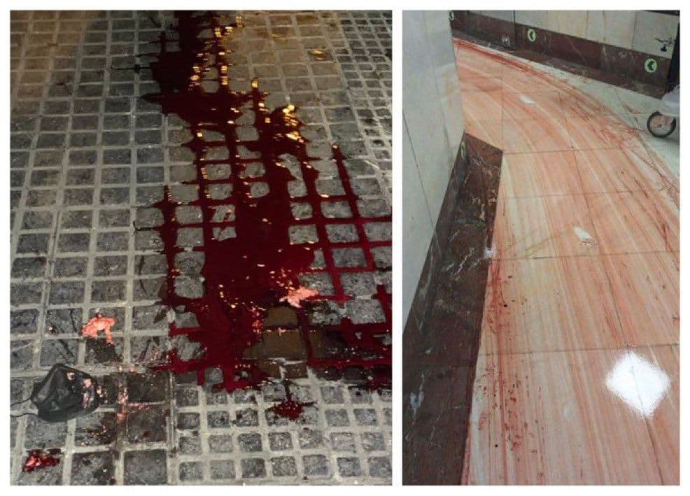 @𝐍𝐢𝐨𝐡 𝐁𝐞𝐫𝐠 🇮🇷 ✡︎: This was Iran during "peacetime" by the way. The image on the left is the street. The image on the right is a hospital floor.
A ceasefire for you does not mean ceasefire for the people trapped with t
